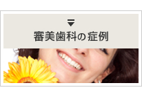 審美歯科の症例