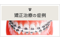 矯正治療の症例