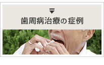 歯周病治療の症例